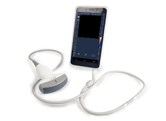 mobile Ultrasound