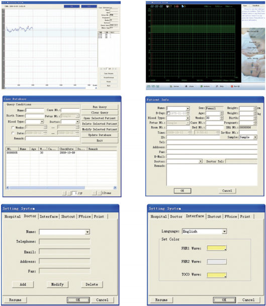 Sonotech Smart ,Fetal doppler probe with USB connector,You may display everything through Sonotech Smart PC software.